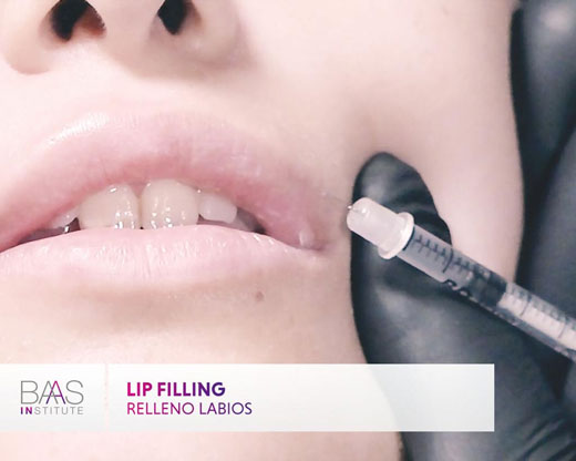 BAAS: Relleno de labios / Lip filling