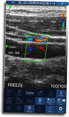 CURSO ECO DOPPLER