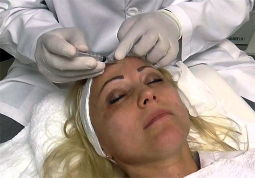 MESOTERAPIA FACIAL