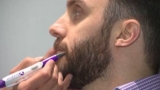 Las consultas por implantes de barba aumentaron entre un 30 y un 40%