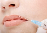 Por qué los pacientes solicitan aumento de labios
