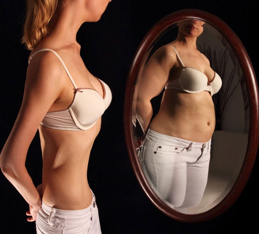 Enfermedades que siguen la moda: Anorexia y Bulimia nerviosas